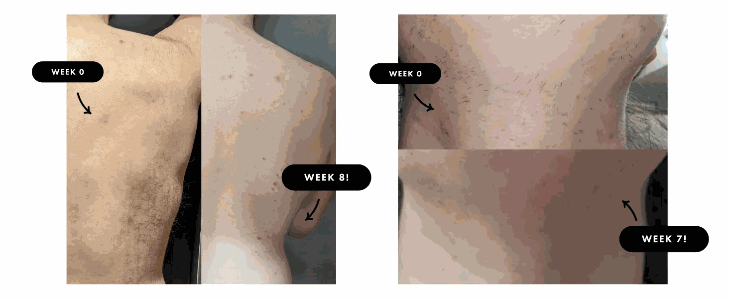 IPL Hair Removal Device with 999,900 Flashes for Full-Body Use-AI01D / US Plug / United States