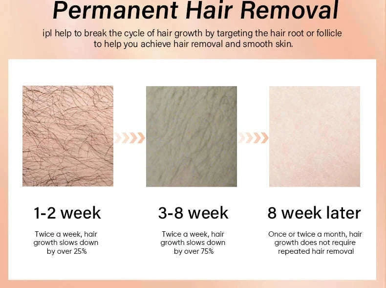 IPL Laser Hair Removal Device with Ice Cooling, 4-in-1 Face & Body-golden / JP / China Mainland
