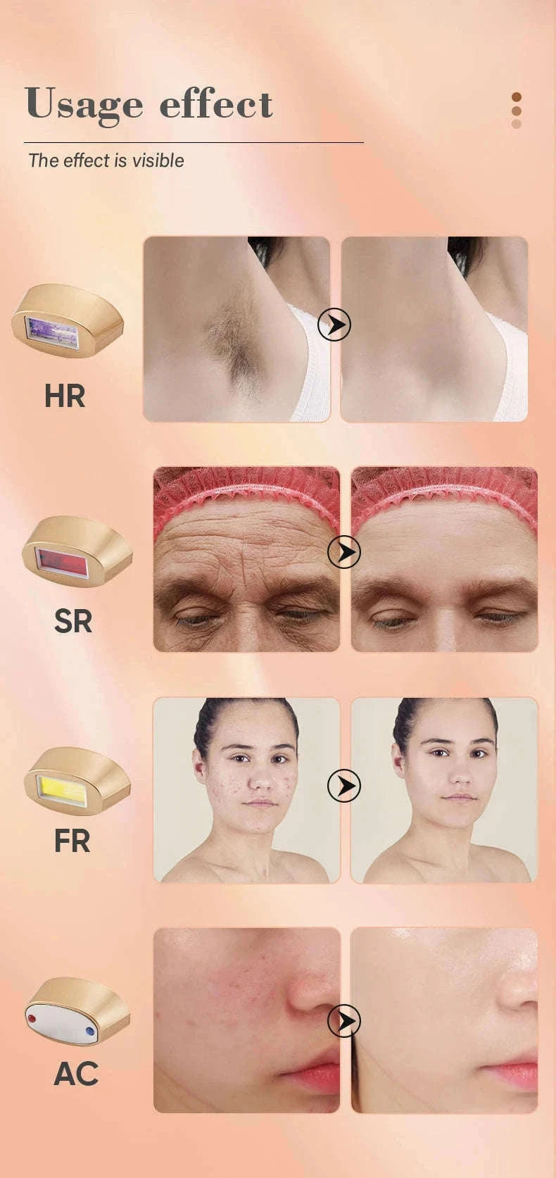 IPL Laser Hair Removal Device with Ice Cooling, 4-in-1 Face & Body-golden / JP / China Mainland