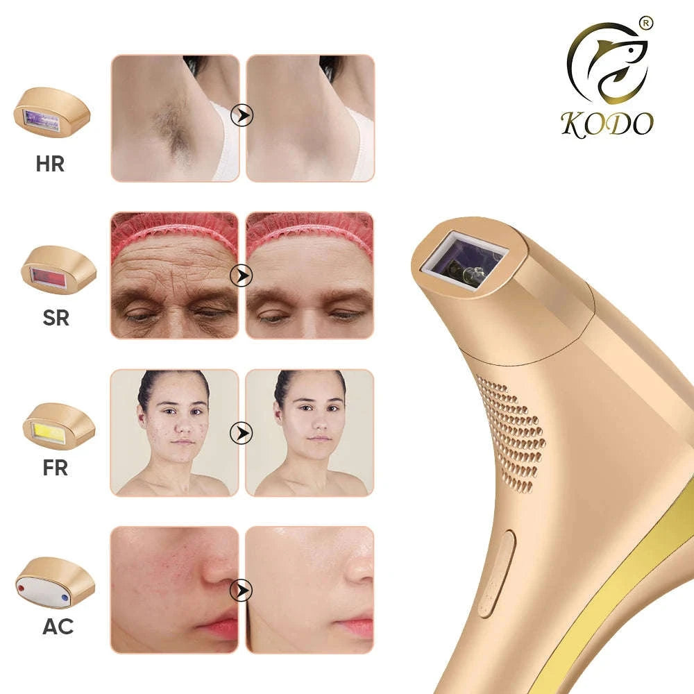 IPL Laser Hair Removal Device with Ice Cooling, 4-in-1 Face & Body-golden / JP / Mexico