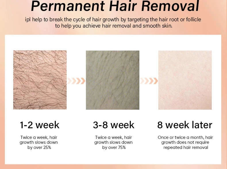 IPL Laser Hair Removal Device with Ice Cooling, 4-in-1 Face & Body-golden / JP / Mexico