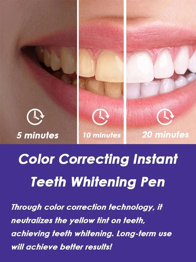 Purple Instant Teeth Whitening Pen for a Brighter, Whiter Smile-2 Pcs