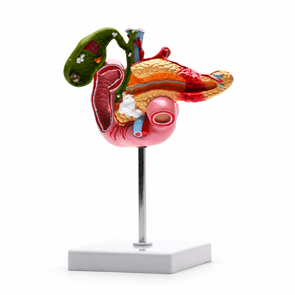 Gallbladder, Pancreas and Duodenum Pathology Teaching Model