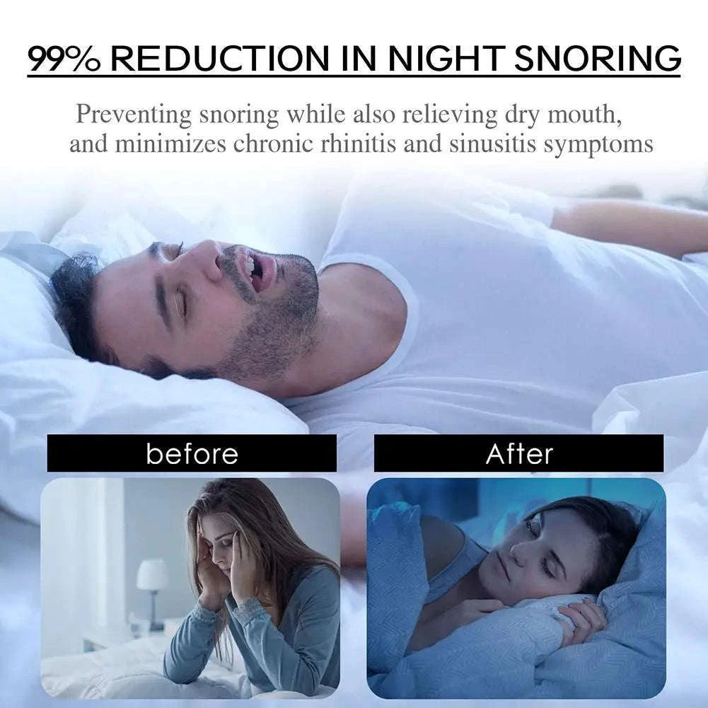 Stop Snoring Patch – Natural Mouth Tape for Better Sleep-1bag / 30pcs
