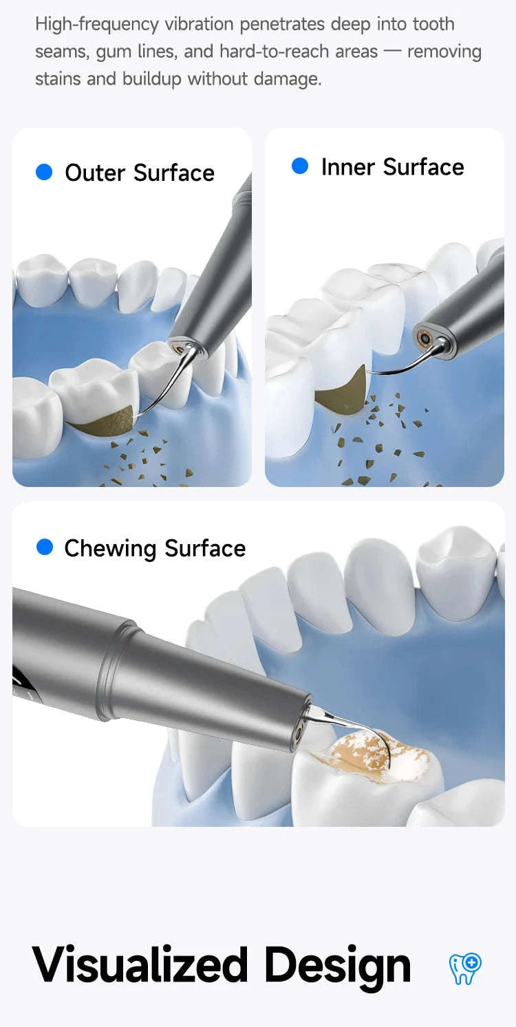 Ultrasonic Tooth Cleaner with Camera Tartar Remover Tool-as show
