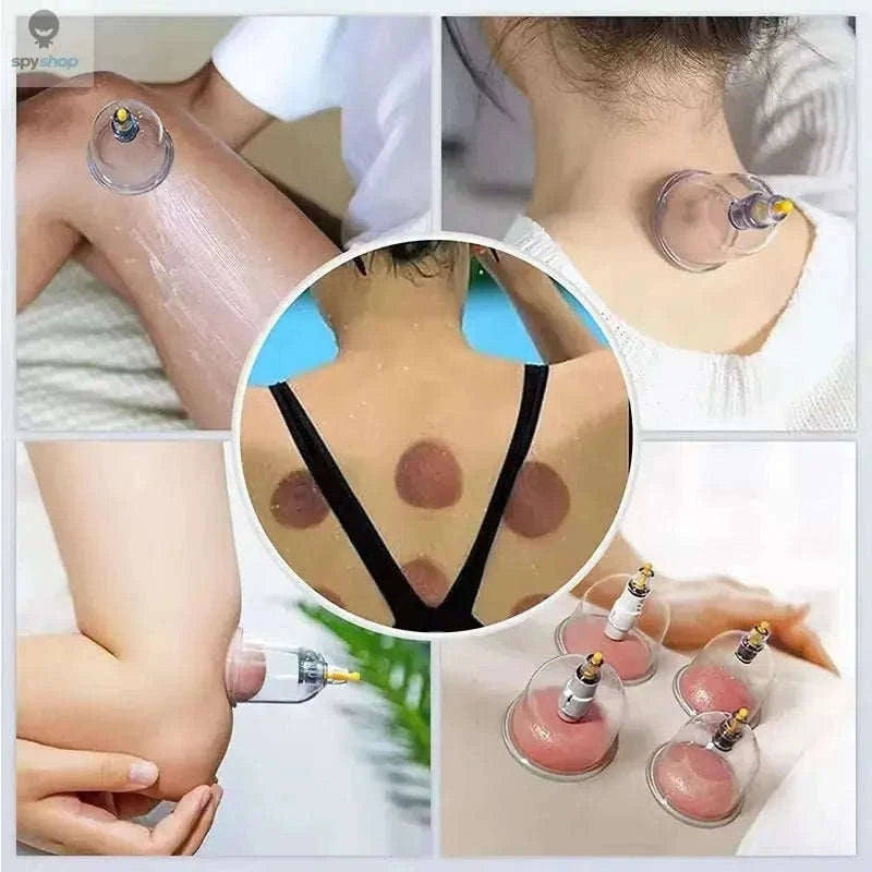 Vacuum Suction Cups for Body Massage and Relaxation-24pcs